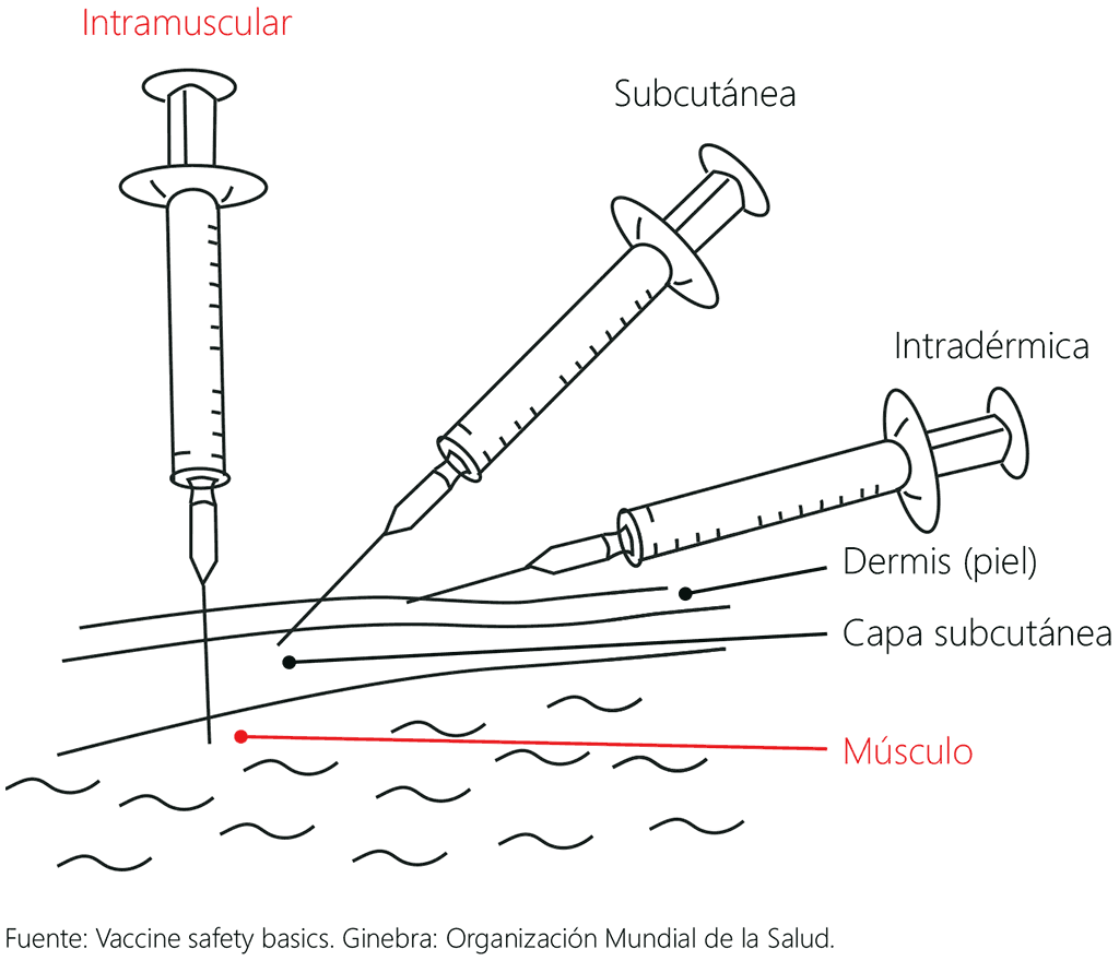 Figure 3.2. Injection techniques